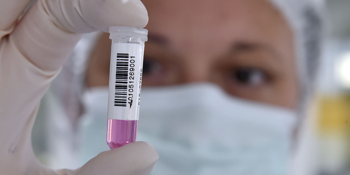 Identificadas proteínas no Brasil que podem diagnosticar autismo na urina