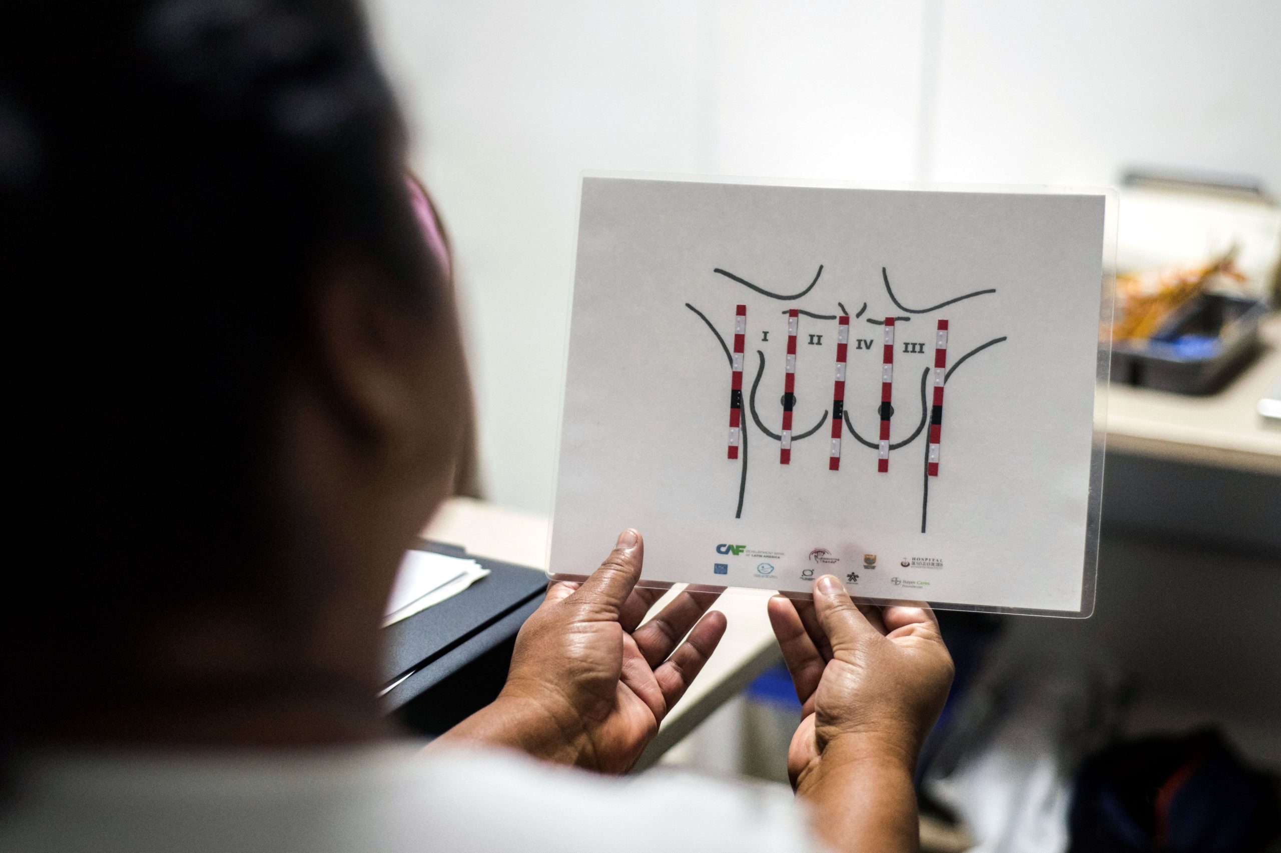 SPO defende teste genético em todas as mulheres com cancro de mama até os 45 anos