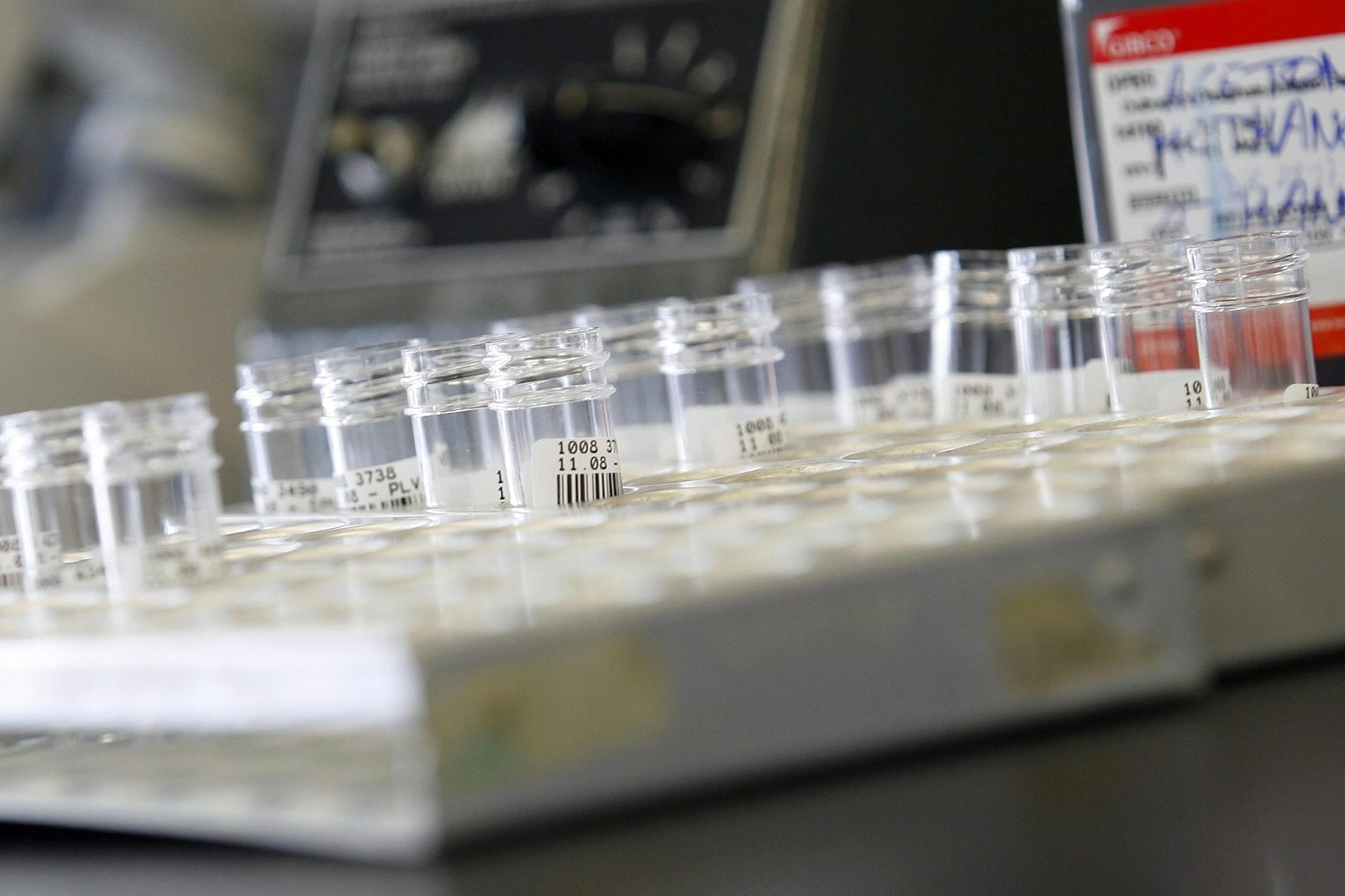 Cientistas chineses testam vacina contra a SIDA em seres humanos