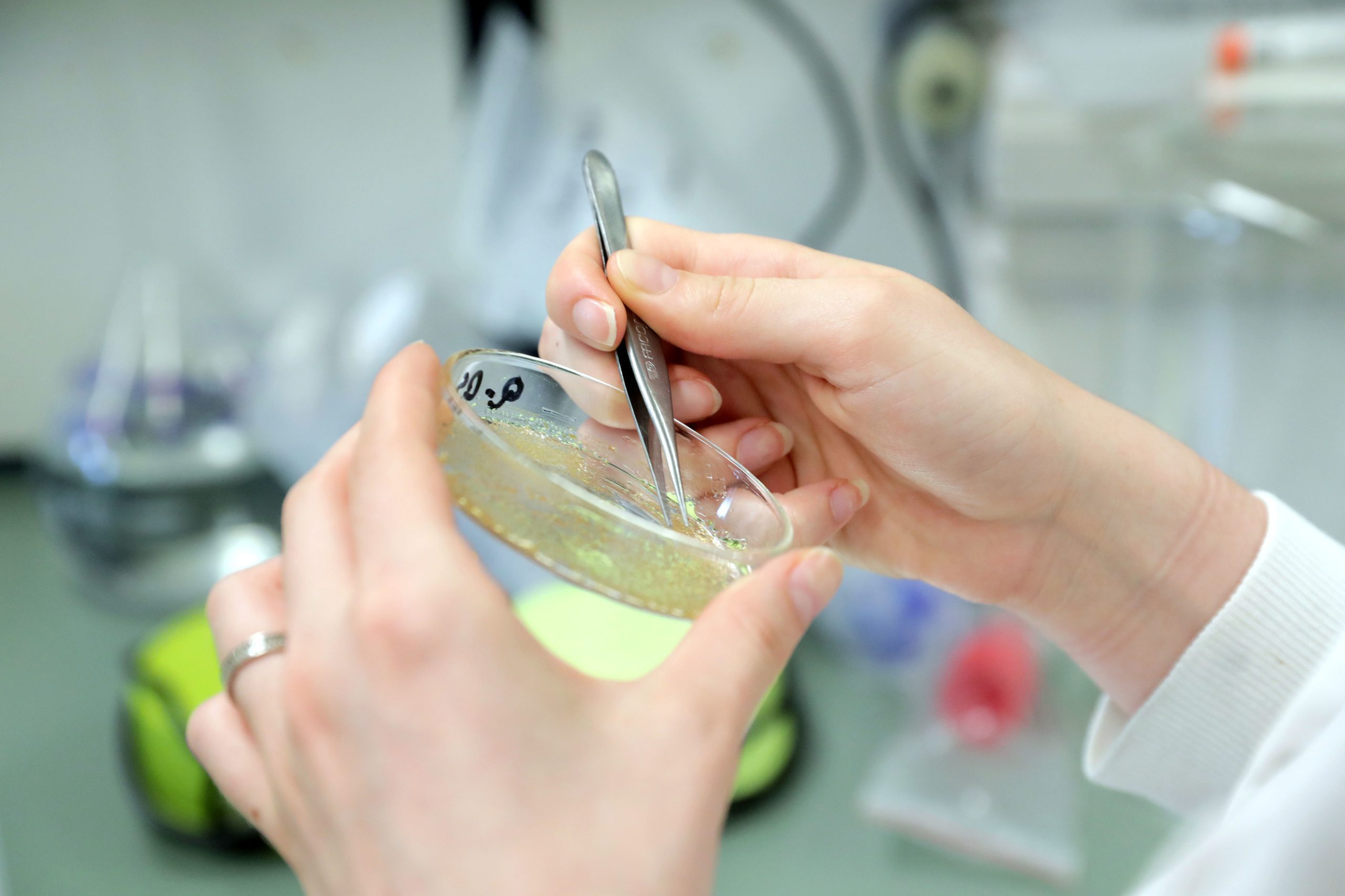 Parasitas de peixes que contaminam humanos tornaram-se 283 vezes mais abundantes nos últimos 50 anos