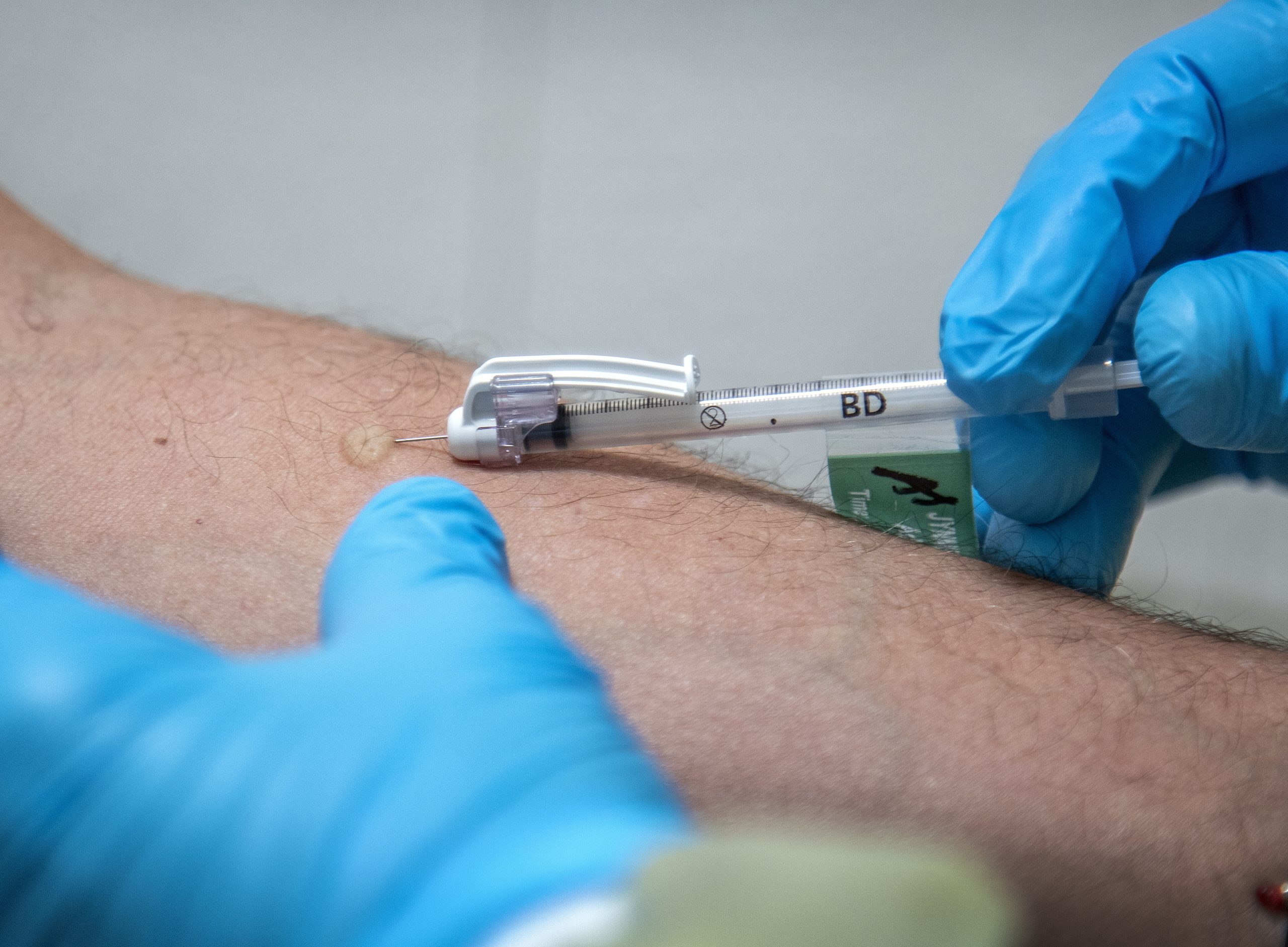 DGS alarga grupos com risco acrescido abrangidos pela vacinação preventiva contra a Monkeypox
