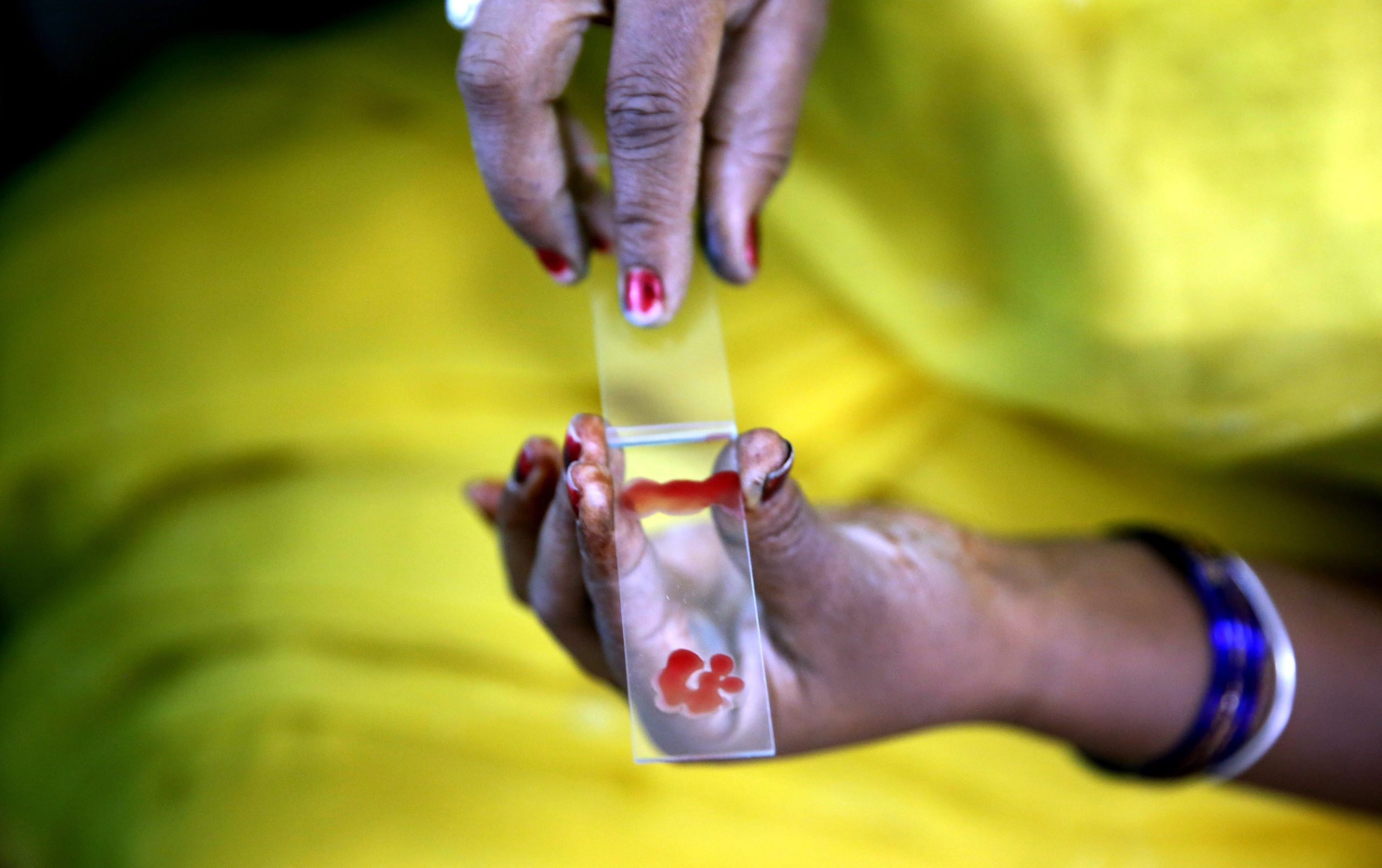 Surto de dengue causa cinco mortes em Díli com centenas de casos diagnosticados