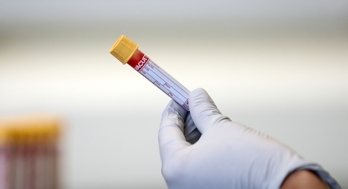 Covid-19: Investigadores espanhóis criam teste que deteta anticorpos invisíveis até agora