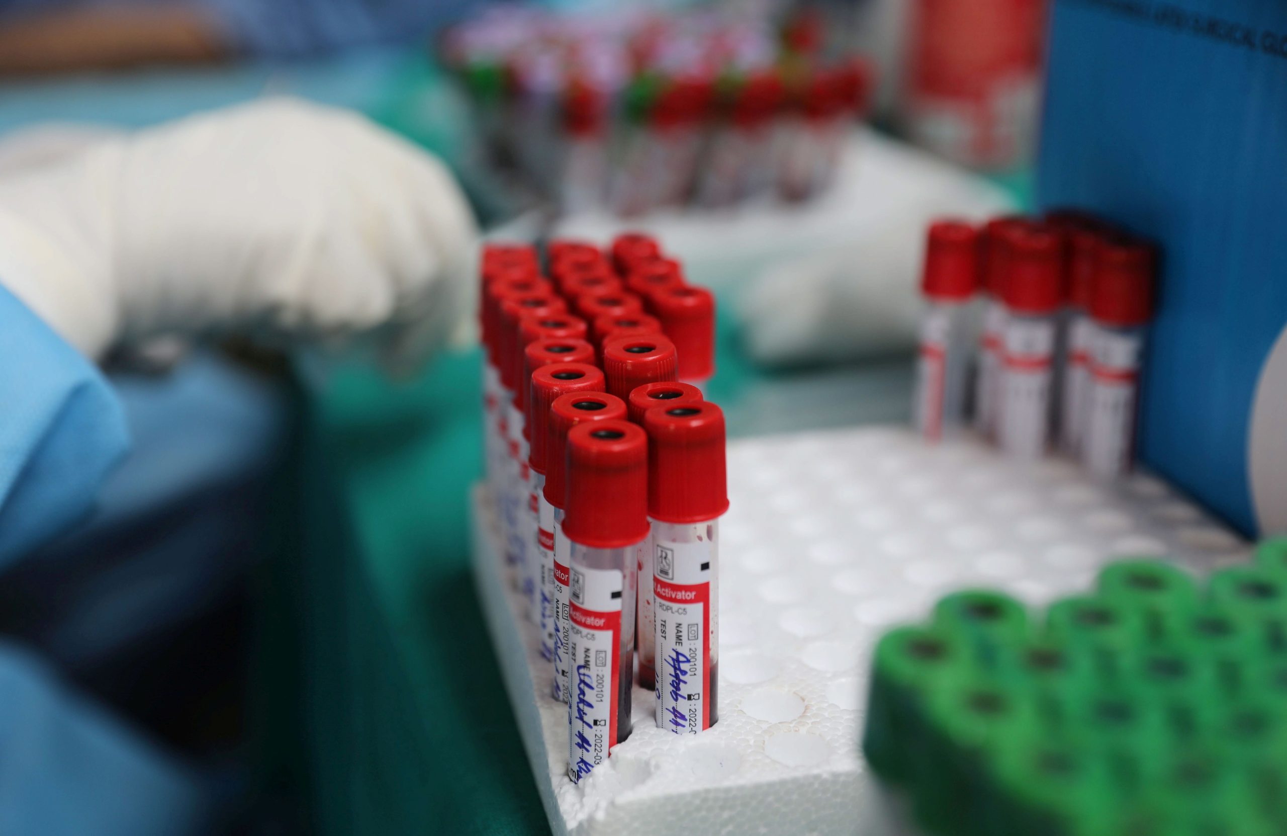 Covid-19: Inscritos cerca de 700 potenciais dadores de plasma sanguíneo convalescente