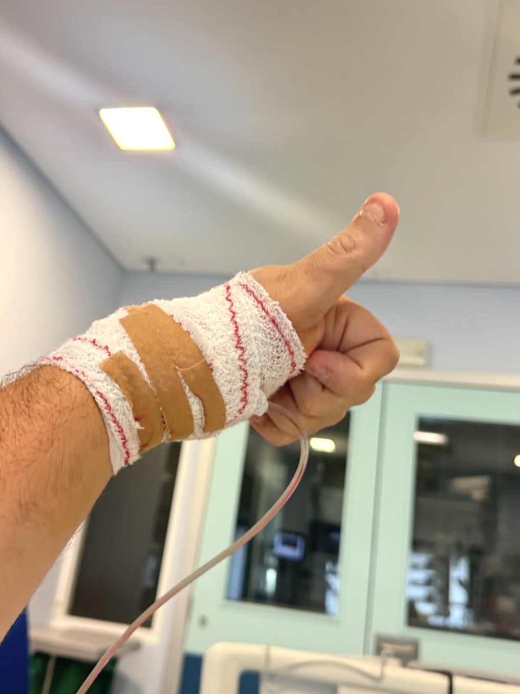 Nuno Markl começa a recuperar controlo do braço
