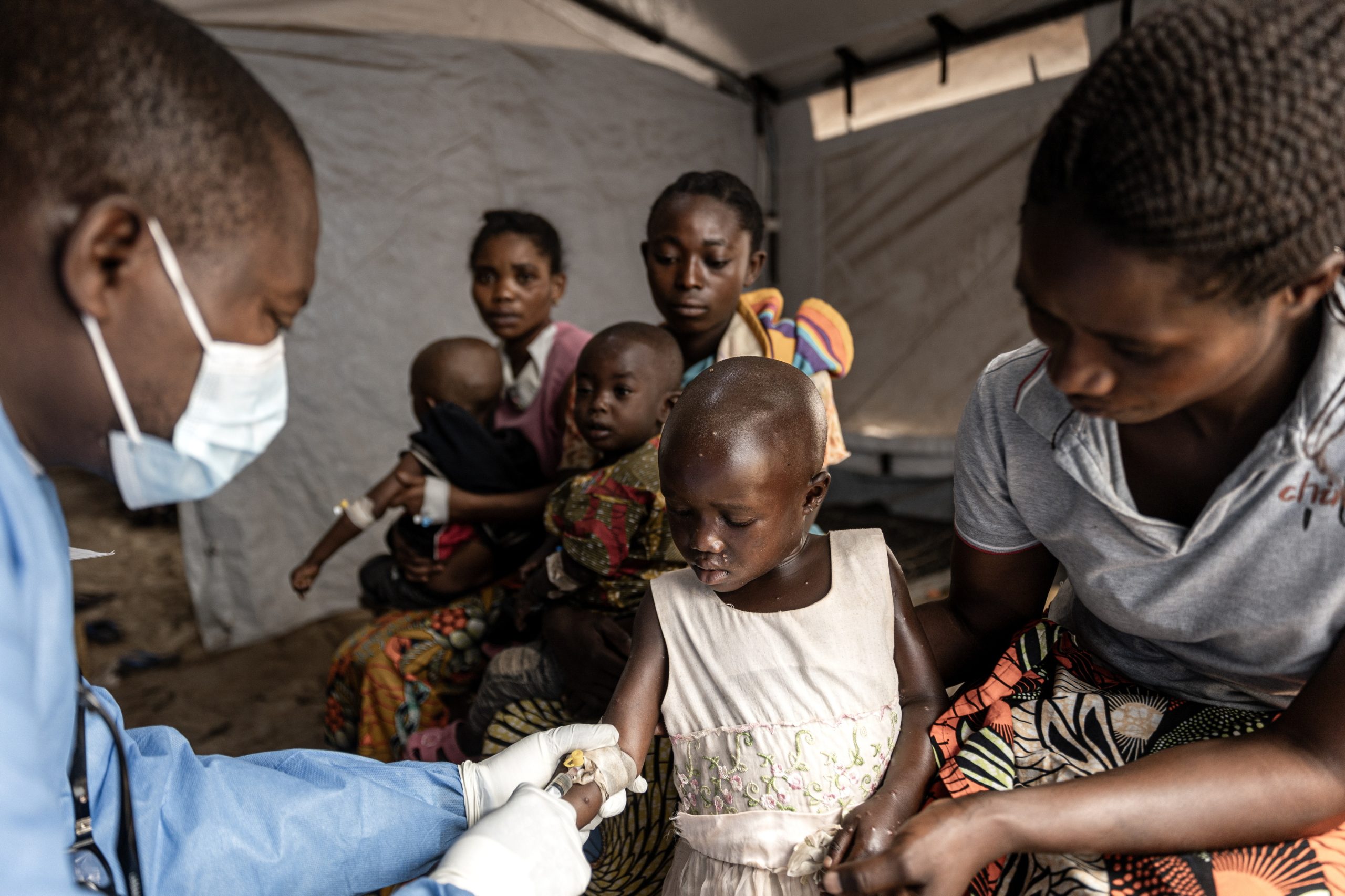 Quase um terço dos infetados com Mpox no Burundi tem menos de cinco anos