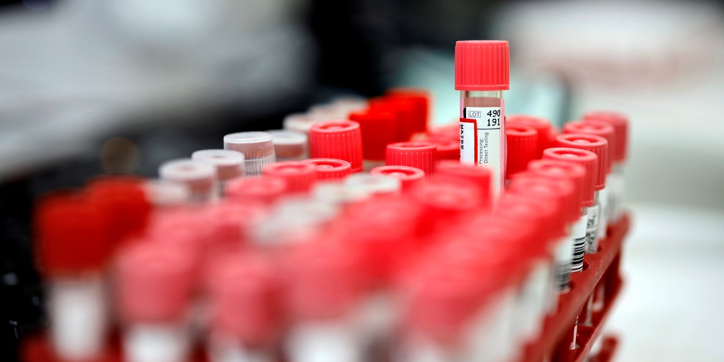 Comissão Europeia está a negociar compra de medicamento remdesivir