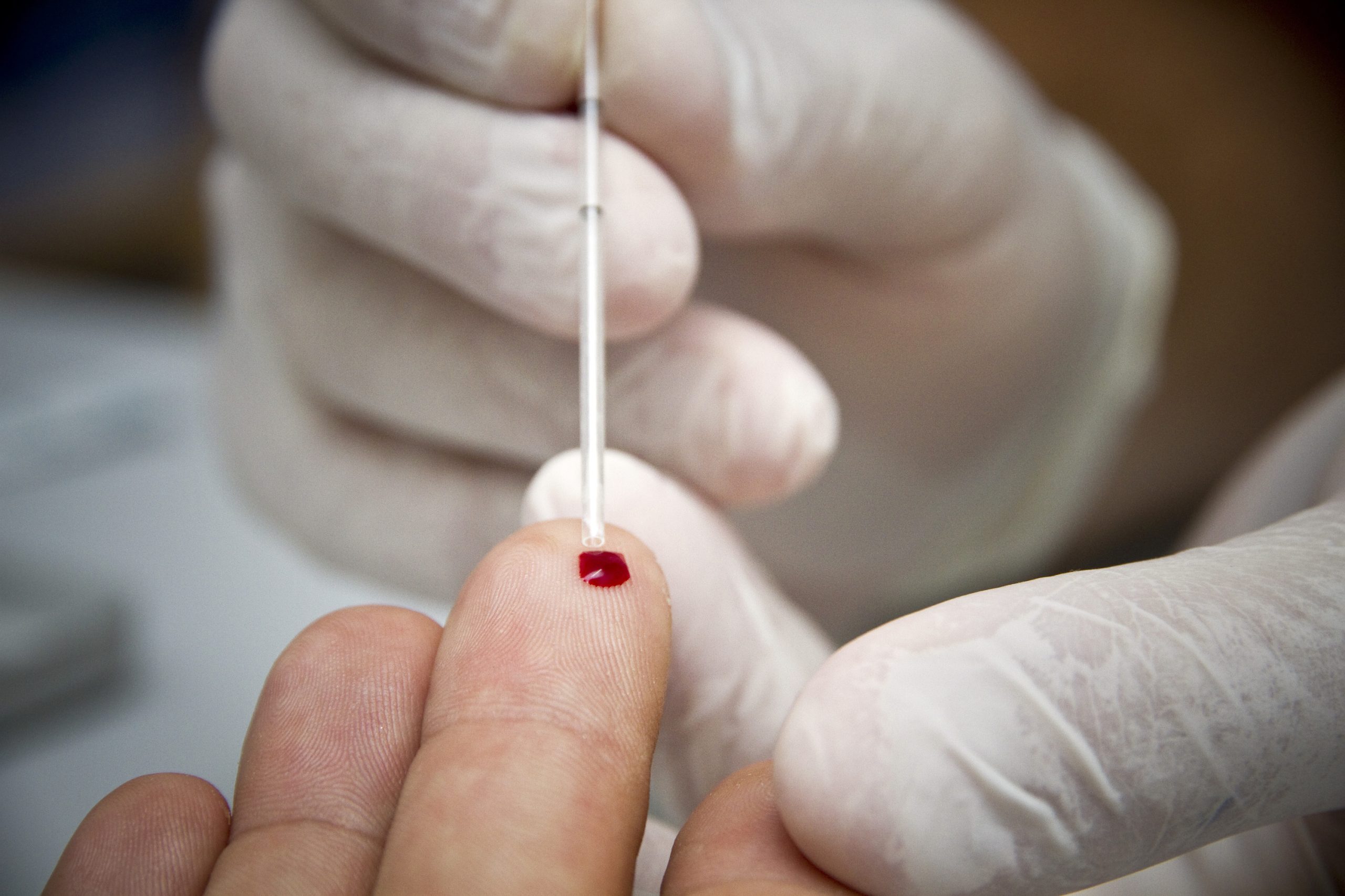 VIH/Sida: Quase oito mil doentes em Portugal não são seguidos